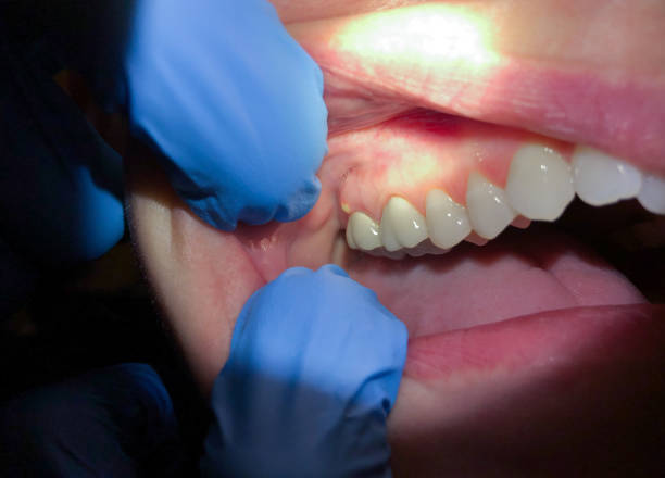 Best Urgent Tooth Repair  in Perryville, AR