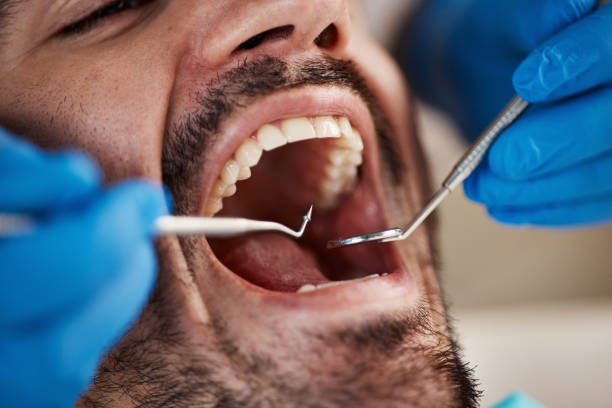 Best Chipped Tooth Repair Near Me  in Perryville, AR